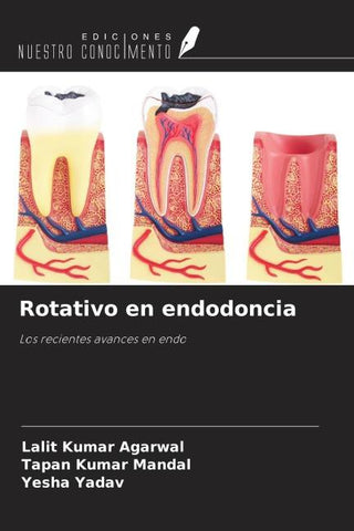 Rotativo en endodoncia