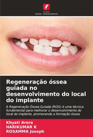Regeneração óssea guiada no desenvolvimento do local do implante