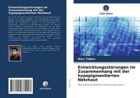 Entwicklungsstörungen im Zusammenhang mit der hypopigmentierten Netzhaut