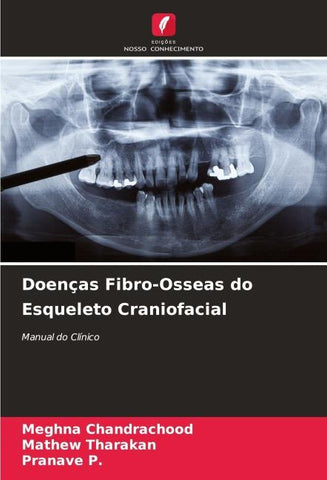 Doenças Fibro-Osseas do Esqueleto Craniofacial