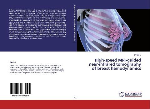 High-speed MRI-guided near-infrared tomography of breast hemodynamics