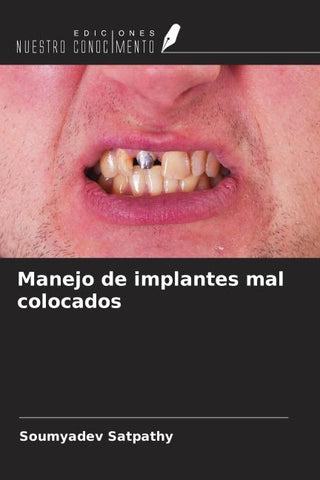 Manejo de implantes mal colocados
