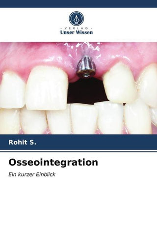 Osseointegration
