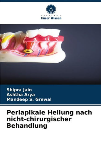 Periapikale Heilung nach nicht-chirurgischer Behandlung