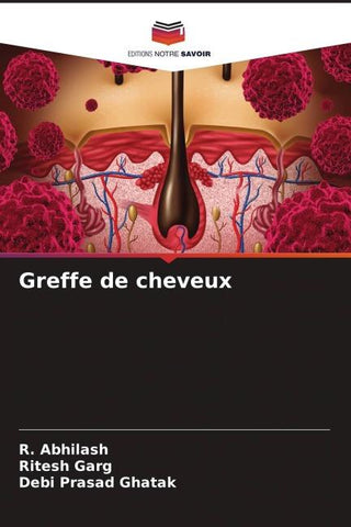 Greffe de cheveux