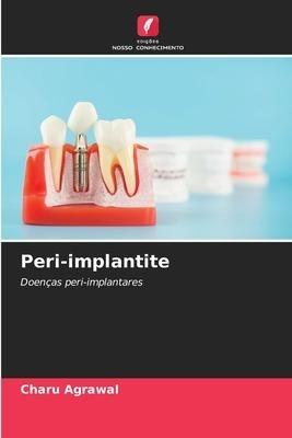 Peri-implantite