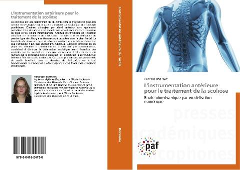 L'instrumentation antérieure pour le traitement de la scoliose
