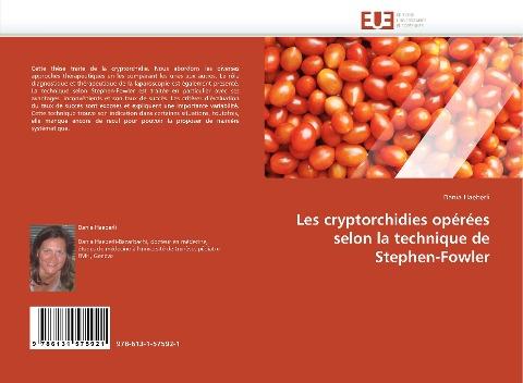 Les cryptorchidies opérées selon la technique de Stephen-Fowler