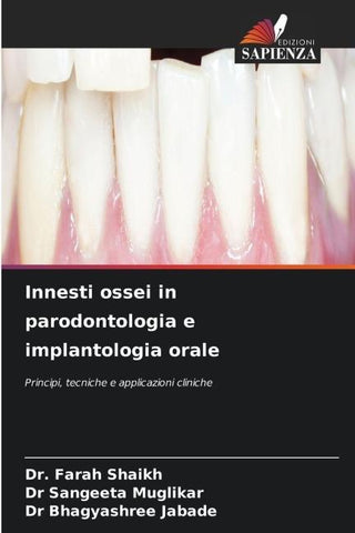 Innesti ossei in parodontologia e implantologia orale