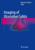 Imaging of Ulcerative Colitis