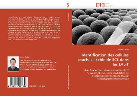 Identification des cellules souches et rôle de SCL dans les LAL-T