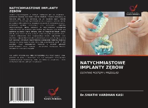 NATYCHMIASTOWE IMPLANTY Z¿BÓW
