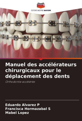 Manuel des accélérateurs chirurgicaux pour le déplacement des dents
