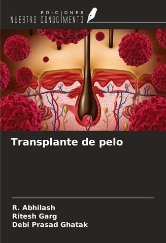 Transplante de pelo