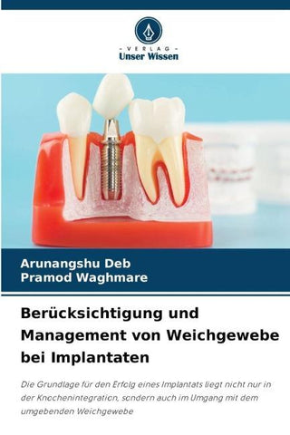 Berücksichtigung und Management von Weichgewebe bei Implantaten