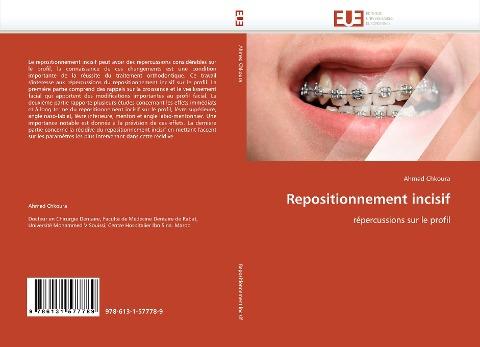 Repositionnement incisif