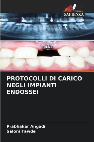 PROTOCOLLI DI CARICO NEGLI IMPIANTI ENDOSSEI