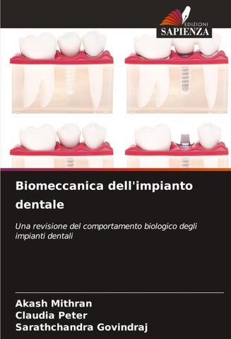 Biomeccanica dell'impianto dentale