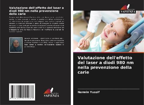 Valutazione dell'effetto del laser a diodi 980 nm nella prevenzione della carie