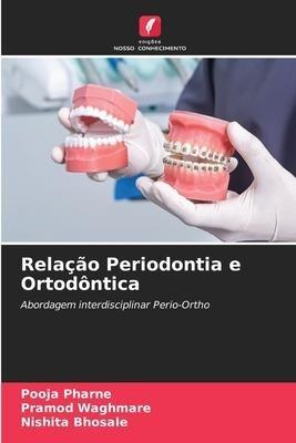 Relação Periodontia e Ortodôntica
