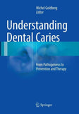 Understanding Dental Caries