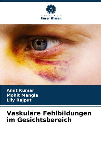 Vaskuläre Fehlbildungen im Gesichtsbereich