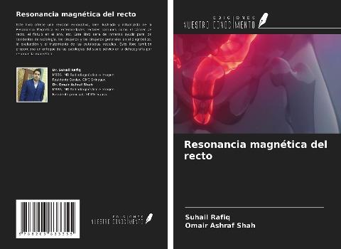 Resonancia magnética del recto