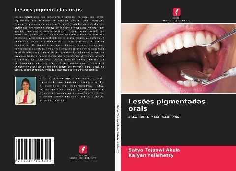 Lesões pigmentadas orais