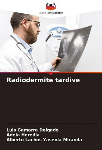Radiodermite tardive