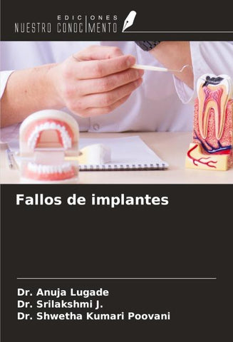 Fallos de implantes