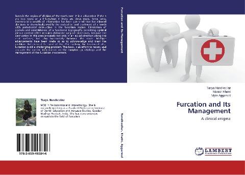 Furcation and Its Management