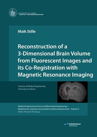 Reconstruction of a 3-Dimensional Brain Volume from Fluorescent Images and its Co-Registration with Magnetic Resonance Imaging