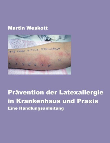 Prävention der Latexallergie in Krankenhaus und Praxis