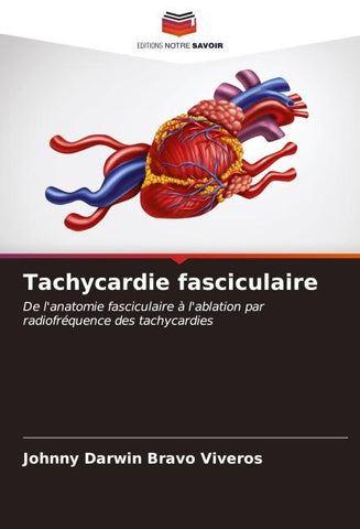 Tachycardie fasciculaire