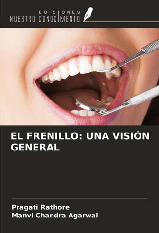 EL FRENILLO: UNA VISIÓN GENERAL