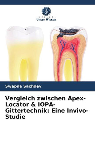 Vergleich zwischen Apex-Locator & IOPA-Gittertechnik: Eine Invivo-Studie