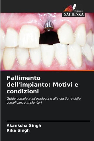 Fallimento dell'impianto: Motivi e condizioni