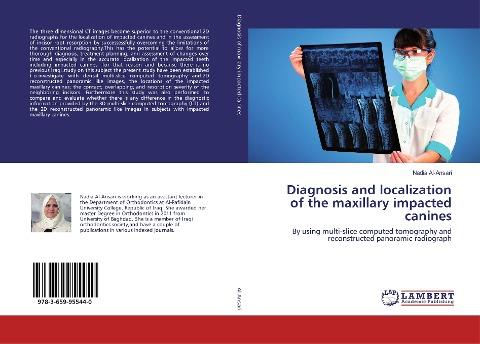 Diagnosis and localization of the maxillary impacted canines