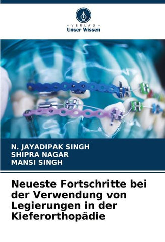 Neueste Fortschritte bei der Verwendung von Legierungen in der Kieferorthopädie