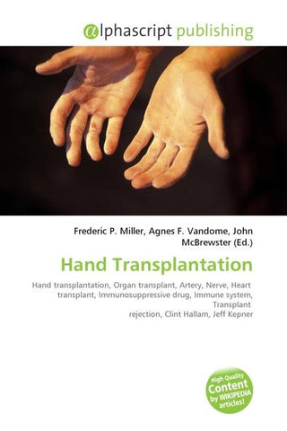 Hand Transplantation