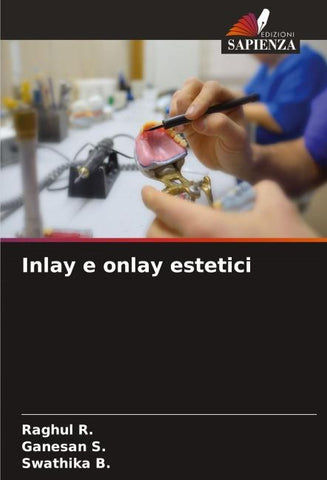 Inlay e onlay estetici