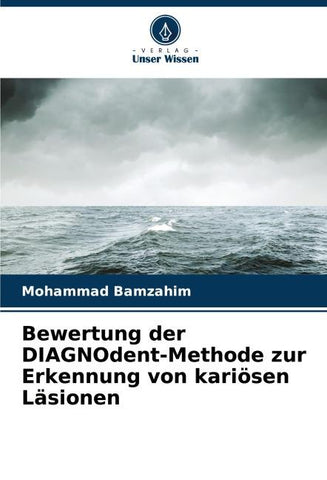 Bewertung der DIAGNOdent-Methode zur Erkennung von kariösen Läsionen