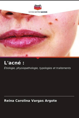 L'acné :