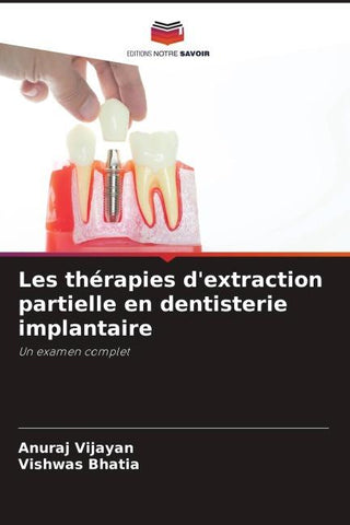 Les thérapies d'extraction partielle en dentisterie implantaire