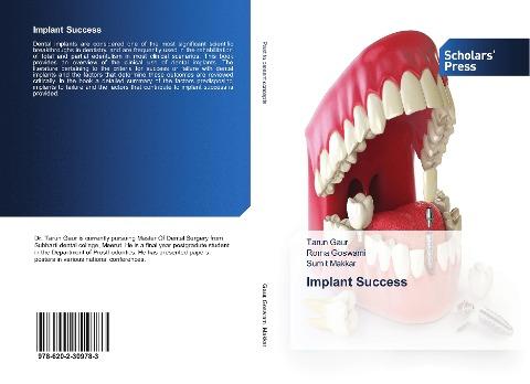 Implant Success