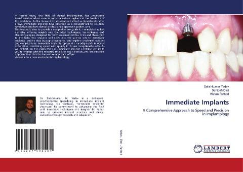 Immediate Implants