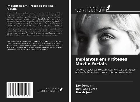 Implantes em Próteses Maxilo-faciais