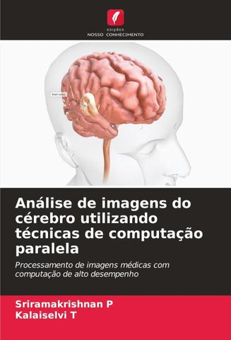Análise de imagens do cérebro utilizando técnicas de computação paralela