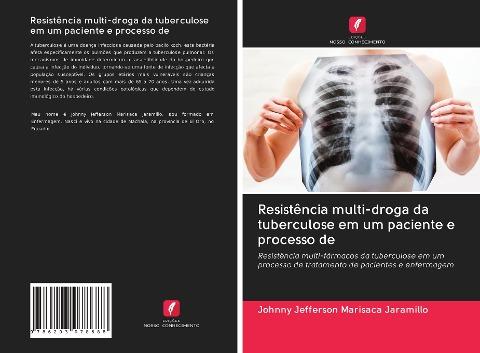 Resistência multi-droga da tuberculose em um paciente e processo de