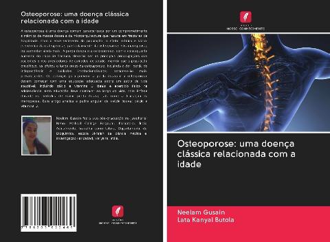 Osteoporose: uma doença clássica relacionada com a idade